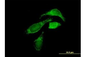 Immunofluorescence of purified MaxPab antibody to OXCT1 on HeLa cell. (OXCT1 抗体  (AA 1-520))