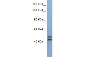 Host:  Rabbit  Target Name:  TEX10  Sample Type:  Fetal Brain lysates  Antibody Dilution:  1. (TEX10 抗体  (Middle Region))