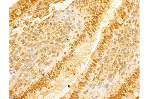 ABIN7094226 and ABIN7098273 at 1/100 staining Rat colon tissue by IHC-P. (FBXO7 抗体  (C-Term))