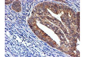 Image no. 11 for anti-NADH Dehydrogenase (Ubiquinone) Complex I, Assembly Factor 7 (NDUFAF7) antibody (ABIN1499667) (NDUFAF7 抗体)