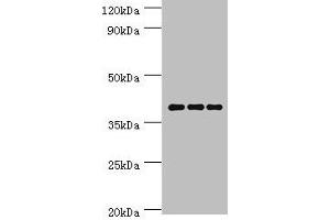 Western blot All lanes: Paired box protein Pax-4 antibody at 6 μg/mL Lane 1: Hela whole cell lysate Lane 2: K562 whole cell lysate Lane 3: Mouse pancreatic Secondary Goat polyclonal to rabbit IgG at 1/10000 dilution Predicted band size: 38, 30 kDa Observed band size: 38 kDa (PAX4 抗体  (AA 50-200))