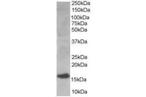 Image no. 1 for anti-Ubiquitin-Conjugating Enzyme E2I (UBE2I) (N-Term) antibody (ABIN374291)