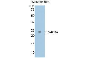 Detection of Recombinant ICAM4, Human using Polyclonal Antibody to Intercellular Adhesion Molecule 4 (ICAM4) (ICAM4 抗体  (AA 52-234))