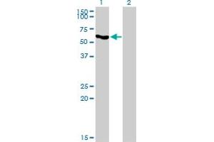 Western Blot analysis of SLC33A1 expression in transfected 293T cell line by SLC33A1 monoclonal antibody (M07), clone 3A4. (SLC33A1 抗体  (AA 1-69))