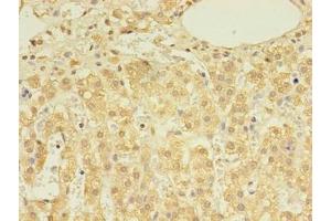 Immunohistochemistry of paraffin-embedded human adrenal gland tissue using ABIN7149631 at dilution of 1:100 (DHRSX 抗体  (AA 32-330))