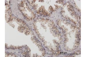 Immunoperoxidase of purified MaxPab antibody to ARG2 on formalin-fixed paraffin-embedded human prostate. (ARG2 抗体  (AA 1-354))