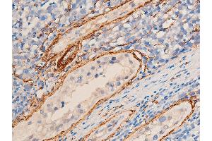 ABIN6267068 at 1/100 staining human seminoma tissue sections by IHC-P. (Smooth Muscle Actin 抗体  (N-Term))