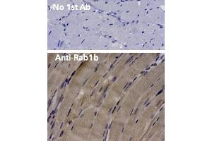 Immunohistochemistry (IHC) image for anti-RAB1B, Member RAS Oncogene Family (RAB1B) (C-Term) antibody (ABIN6254186) (RAB1B 抗体  (C-Term))