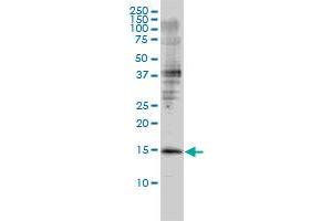 GMFB monoclonal antibody (M01), clone 2G12-2A2 Western Blot analysis of GMFB expression in Jurkat . (GMFB 抗体  (AA 1-154))