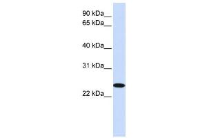 Western Blotting (WB) image for anti-Zinc Finger, DHHC-Type Containing 19 (ZDHHC19) antibody (ABIN2458905) (ZDHHC19 抗体)