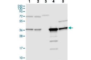 Western blot analysis of Lane 1: RT-4, Lane 2: U-251 MG, Lane 3: Human Plasma, Lane 4: Liver, Lane 5: Tonsil with C11orf54 polyclonal antibody . (C11orf54 抗体)