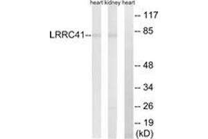 Western blot analysis of extracts from rat kidney/rat heart cells, using LRRC41 Antibody. (LRRC41 抗体  (AA 391-440))
