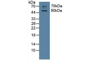 Detection of CHRM1 in Rat Brain Tissue using Polyclonal Antibody to Cholinergic Receptor, Muscarinic 1 (CHRM1) (CHRM1 抗体  (AA 210-363))