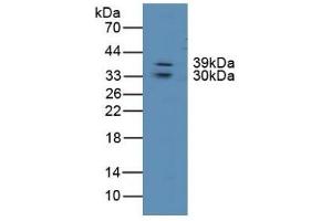Detection of LIPG in Human Lung Tissue using Polyclonal Antibody to Lipase, Endothelial (LIPG) (LIPG 抗体  (AA 175-412))