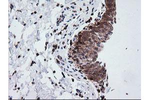 Image no. 4 for anti-Differentially Expressed in FDCP 6 Homolog (DEF6) antibody (ABIN1497808)