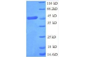 Tumor Necrosis Factor Receptor Superfamily, Member 1A (TNFRSF1A) (AA 31-210) protein (GST tag)