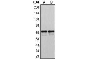 Western blot analysis of Cytochrome P450 2U1 expression in LOVO (A), A2058 (B) whole cell lysates. (CYP2U1 抗体  (Center))