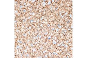 Immunohistochemistry of paraffin-embedded mouse brain using V Rabbit mAb (ABIN7271312) at dilution of 1:100 (40x lens).