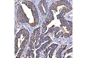 IHC analysis of Syntaxin 18/STX18 using anti-Syntaxin 18/STX18 antibody (ABIN7599259).