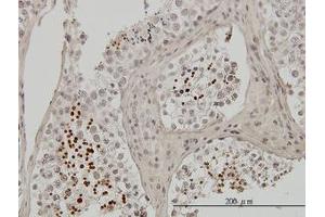 Image no. 1 for anti-Transition Protein 1 (During Histone To Protamine Replacement) (TNP1) (AA 1-56) antibody (ABIN598980) (TNP1 抗体  (AA 1-56))