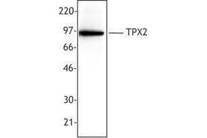 Western Blotting (WB) image for anti-TPX2, Microtubule-Associated, Homolog (Xenopus Laevis) (TPX2) antibody (ABIN2665435) (TPX2 抗体)