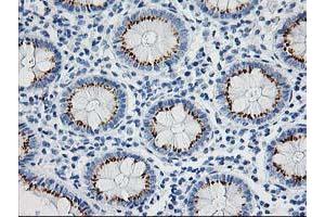 Immunohistochemical staining of paraffin-embedded Human colon tissue using anti-NDEL1 mouse monoclonal antibody. (NDEL1 抗体)