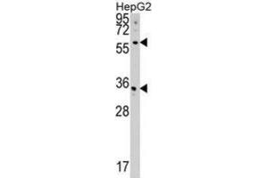 Western Blotting (WB) image for anti-CDP-Diacylglycerol Synthase (Phosphatidate Cytidylyltransferase) 2 (CDS2) antibody (ABIN5018827) (CDS2 抗体)