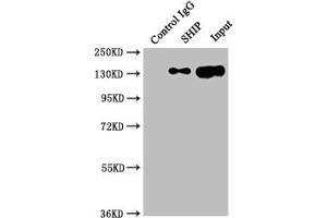 Immunoprecipitating SHIP in Raji whole cell lysate Lane 1: Rabbit control IgG instead of ABIN7127806 in Raji whole cell lysate. (Recombinant INPP5D 抗体)