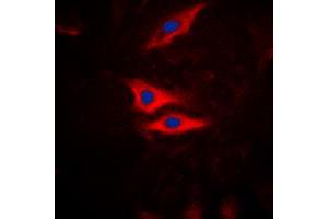 Immunofluorescent analysis of PLA2G4A (pS505) staining in HeLa cells. (PLA2G4A 抗体  (pSer505))