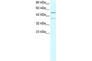 USP3 antibody used at 1. (USP3 抗体  (N-Term))