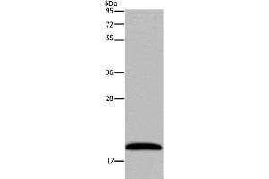 Western Blot analysis of 293T cell using NDUFA8 Polyclonal Antibody at dilution of 1:300 (NDUFA8 抗体)