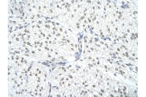 Rabbit Anti-SNRPA Antibody       Paraffin Embedded Tissue:  Human cardiac cell   Cellular Data:  Epithelial cells of renal tubule  Antibody Concentration:   4. (SNRPA1 抗体  (Middle Region))