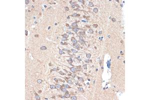 Immunohistochemistry of paraffin-embedded rat brain using P Rabbit mAb (ABIN7269161) at dilution of 1:100 (40x lens). (PAK3 抗体)