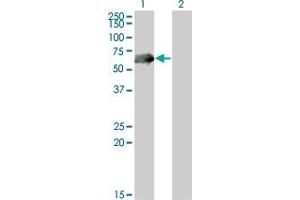 Western Blot analysis of CDC25C expression in transfected 293T cell line by CDC25C monoclonal antibody (M01A), clone 3B11. (CDC25C 抗体  (AA 21-130))