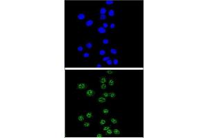 Confocal immunofluorescent analysis of NBN Antibody (C-term) (ABIN655721 and ABIN2845169) with Hela cell followed by Alexa Fluor® 488-conjugated goat anti-rabbit lgG (green). (Nibrin 抗体  (C-Term))
