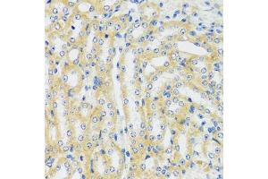 Immunohistochemistry of paraffin-embedded mouse kidney using CaMKI antibody (ABIN7266017) at dilution of 1:100 (40x lens). (CAMK1 抗体  (AA 1-93))