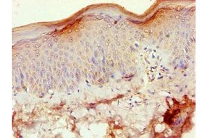 Immunohistochemistry of paraffin-embedded human skin tissue using ABIN7170845 at dilution of 1:100 (MMP3 抗体  (AA 100-477))