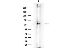 Western blot analysis of lysates from Rat brain, using Fyn Mouse Monoclonal Antibody at 1/1000 dilution.