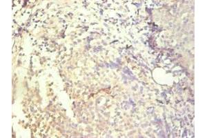 Immunohistochemical of paraffin-embedded human tonsil tissue using ABIN7156932 at dilution of 1:200.