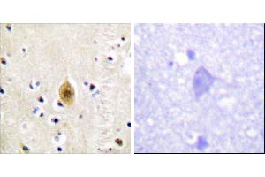 Immunohistochemistry analysis of paraffin-embedded human brain tissue, using Mst1/2 (Phospho-Thr183) antibody. (MST1/MST2 (pThr183) 抗体)