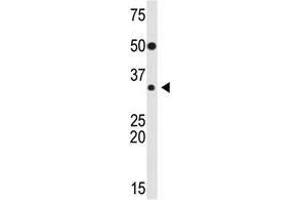 Image no. 1 for anti-Snail Family Zinc Finger 2 (SNAI2) (Middle Region) antibody (ABIN2853627) (SLUG 抗体  (Middle Region))