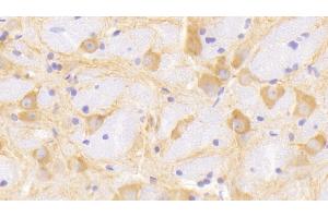 Immunohistochemistry (IHC) image for anti-Microtubule-Associated Protein 2 (MAP2) (AA 1459-1718) antibody (ABIN7438808)