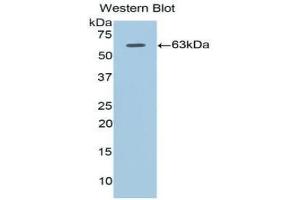 Western blot analysis of the recombinant protein. (Adiponectin Receptor 1 抗体  (AA 1-136))