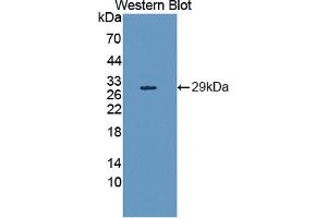 Western blot analysis of the recombinant protein. (HAND1 抗体  (AA 1-215))