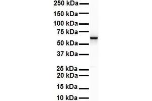WB Suggested Anti-SNRP70 antibody Titration: 1 ug/mL Sample Type: Human Raji (SNRNP70 抗体  (C-Term))