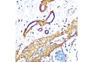 Immunohistochemistry of paraffin-embedded human colon using Filamin A Rabbit mAb (ABIN1682545, ABIN3018024, ABIN3018025 and ABIN7101570) at dilution of 1:100 (40x lens). (Filamin A 抗体)