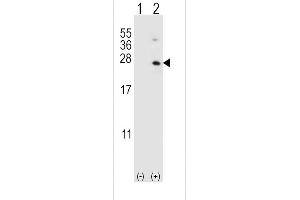 Western blot analysis of HPRT1 (arrow) using rabbit polyclonal HPRT1 Antibody (C-term) (ABIN390692 and ABIN2840982). (HPRT1 抗体  (C-Term))