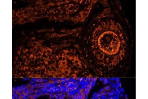 Immunofluorescence analysis of Mouse oophoroma cells using ZP2 Polyclonal Antibody at dilution of 1:100. (ZP2 抗体)