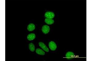 Immunofluorescence of purified MaxPab antibody to ZNF354A on MCF-7 cell. (ZNF354A 抗体  (AA 1-605))