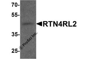 Western Blotting (WB) image for anti-Reticulon 4 Receptor-Like 2 (RTN4RL2) (C-Term) antibody (ABIN1077412) (RTN4RL2 抗体  (C-Term))
